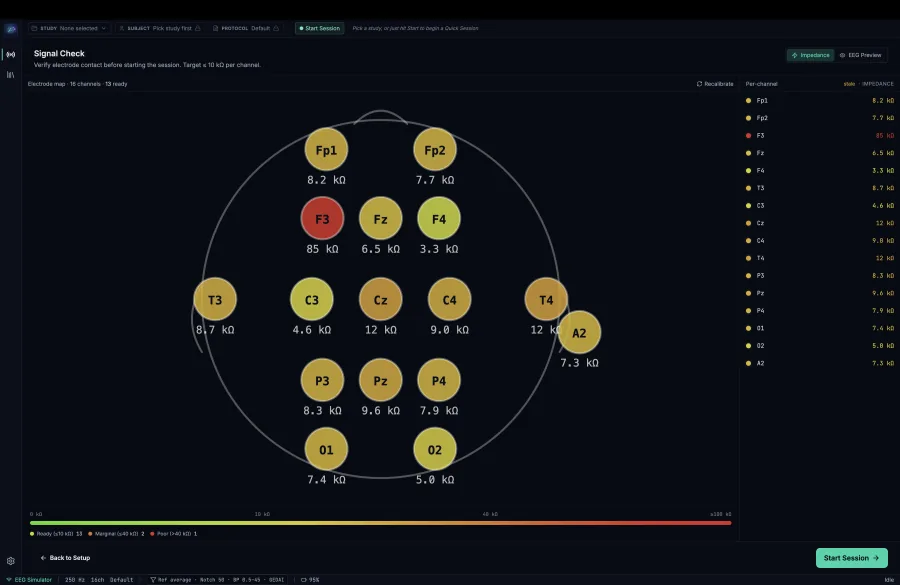 NeuroFlux - electrode impedance check across the 16-channel montage